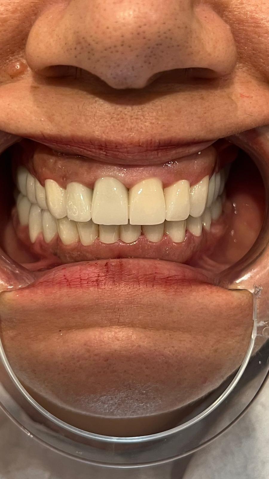 ECE Dental Patient Transformation